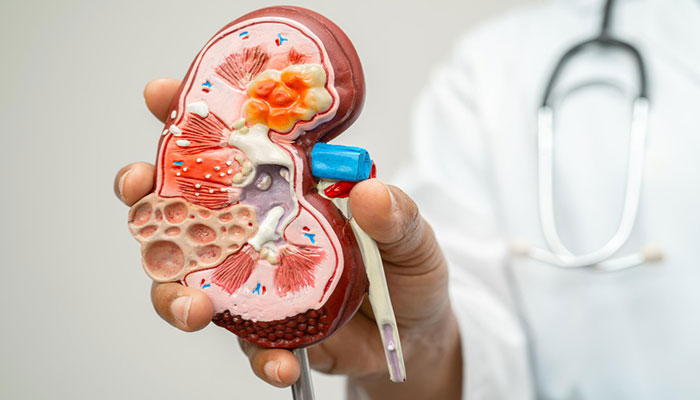 Kidney Disease Treatment